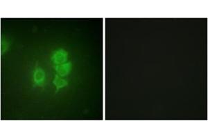 Immunofluorescence analysis of HuvEc cells, using MSK1 Antibody . (MSK1 anticorps  (Internal Region))