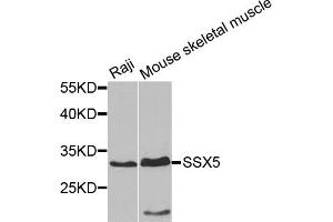 Western blot analysis of extracts of various cell lines, using SSX5 antibody. (SSX5 anticorps)