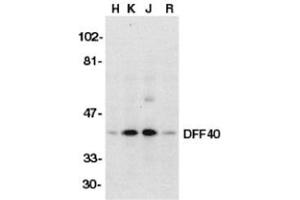 Western blot analysis of DFF40 in HeLa (H), K562 (K), Jurkat (J), and Raji (R) whole cell lysate with AP30286PU-N DFF40 antibody (I18) at 1/500 dilution. (DFFB anticorps)