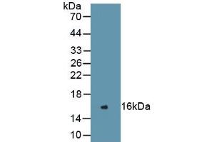 WB of Protein Standard: different control antibodies against Highly purified E.