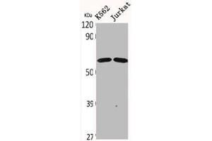 Western Blot analysis of K562 Jurkat cells using CDYL2 Polyclonal Antibody (CDYL2 anticorps  (N-Term))