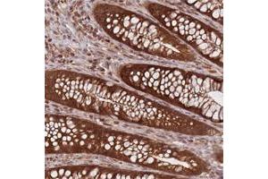Immunohistochemical staining of human stomach with CXorf57 polyclonal antibody  shows strong nuclear, cytoplasmic and membranous positivity in glandular cells. (CXORF57 anticorps)