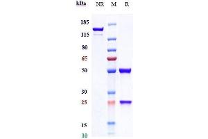 Anti-GUCY2C Reference Antibody (indusatumab) on SDS-PAGE under reducing (R) condition. (Recombinant GUCY2C (Indusatumab Biosimilar) anticorps)