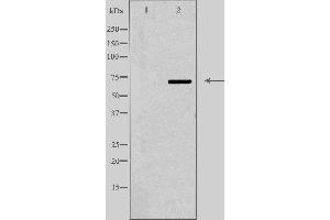 Western blot analysis of extracts from HepG2 cells, using ABCD4 antibody.