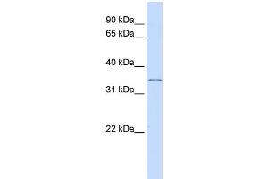 WB Suggested Anti-KCNRG Antibody Titration:  0. (KCNRG anticorps  (Middle Region))