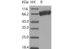 Western Blotting (WB) image for Activated Leukocyte Cell Adhesion Molecule (ALCAM) (Active) protein (His tag) (ABIN7320442) (CD166 Protein (His tag))