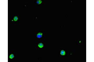 Immunofluorescent analysis of Hela cells using ABIN7154103 at dilution of 1:100 and Alexa Fluor 488-congugated AffiniPure Goat Anti-Rabbit IgG(H+L) (GSTM1 anticorps  (AA 24-156))