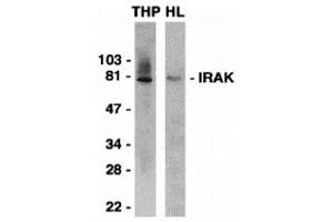 Western Blotting (WB) image for anti-Interleukin-1 Receptor-Associated Kinase 1 (IRAK1) (C-Term) antibody (ABIN1030443) (IRAK1 anticorps  (C-Term))