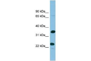 WB Suggested Anti-PDYN Antibody Titration: 0.