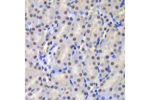 Immunohistochemistry of paraffin-embedded mouse kidney using GSTP1 antibody.