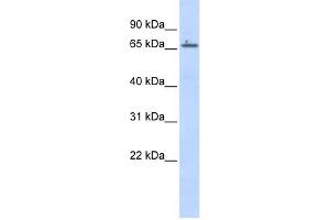 WB Suggested Anti-ZNF503 Antibody Titration: 0. (ZNF503 anticorps  (Middle Region))
