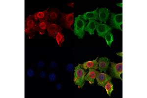 ABIN6264810 and ABIN6278517 staining Hela cells by IF/ICC. (RPA4 anticorps  (Internal Region))