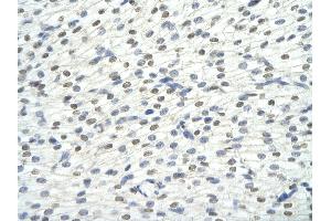 Rabbit Anti-KHDRBS1 antibody Catalog Number: ARP40665  Paraffin Embedded Tissue: Human Heart cell Cellular Data: cardiac cell of renal tubule Antibody Concentration: 4.