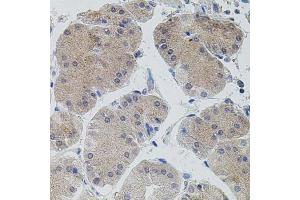 Immunohistochemistry of paraffin-embedded human stomach using MAP3K5 antibody (ABIN1873618) (40x lens).