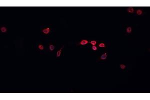 ABIN6266587 staining HeLa  cells by IF/ICC. (MCM5 anticorps  (N-Term))