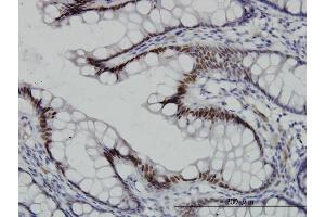 Immunoperoxidase of monoclonal antibody to TCF7L2 on formalin-fixed paraffin-embedded human colon.