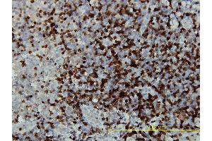 Immunoperoxidase of monoclonal antibody to CAMK4 on formalin-fixed paraffin-embedded human tonsil tissue. (CAMK4 anticorps  (AA 1-473))