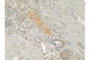 ABIN6257012 and ABIN6274964 at 1/100 staining human normal liver tissue by IHC-P.
