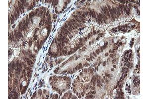 Image no. 1 for anti-Von Hippel-Lindau Tumor Suppressor, E3 Ubiquitin Protein Ligase (VHL) antibody (ABIN1501712)