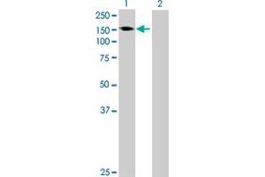 Western Blot analysis of AKAP1 expression in transfected 293T cell line by AKAP1 MaxPab polyclonal antibody. (AKAP1 anticorps  (AA 1-903))