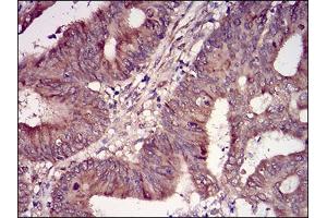Fig. (CSNK2B anticorps  (AA 1-215))