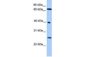 WB Suggested Anti-L3MBTL2 Antibody Titration: 0. (L3MBTL2 anticorps  (N-Term))