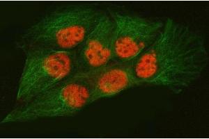 IF analysis of SNRPA1 and Tubulin beta using anti-SNRPA1 antibody (ABIN7599131) and anti-Tubulin beta antibody (ABIN7602744).