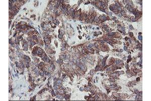 Image no. 6 for anti-Carboxypeptidase A2 (Pancreatic) (CPA2) antibody (ABIN1497596)