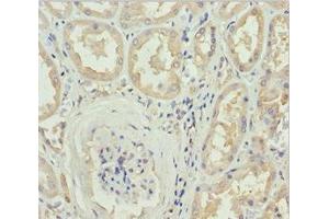 Immunohistochemistry of paraffin-embedded human kidney tissue using ABIN7149603 at dilution of 1:100 (DOCK8 anticorps  (AA 1900-2099))