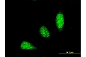 Immunofluorescence of monoclonal antibody to TRIM31 on HeLa cell. (TRIM31 anticorps  (AA 1-100))