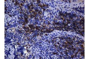 Immunohistochemistry (IHC) image for anti-T-cell surface glycoprotein CD1c (CD1C) antibody (ABIN2670676) (CD1c anticorps)