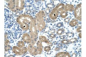 TRNT1 antibody was used for immunohistochemistry at a concentration of 16. (Trnt1 anticorps  (N-Term))