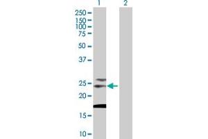 Western Blot analysis of TSPAN31 expression in transfected 293T cell line by TSPAN31 MaxPab polyclonal antibody. (TSPAN31 anticorps  (AA 1-210))