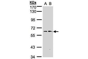 WB Image Sample(30 ug whole cell lysate) A:Hep G2 , B:Raji , 7. (FMO1 anticorps)