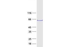 Validation with Western Blot