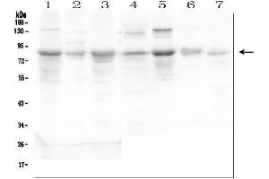 Western blot analysis of SEMA3C using anti-SEMA3C antibody (ABIN6719618).