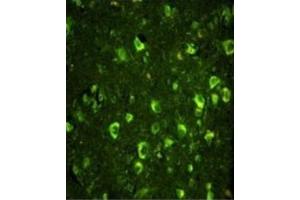 Immunofluorescence (IF) image for anti-Abl-Interactor 1 (ABI1) antibody (ABIN3003792) (ABI1 anticorps)