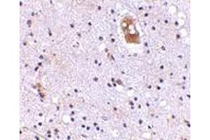 Immunohistochemistry of EVER2 in human brain with EVER2 antibody at 5 μg/ml.