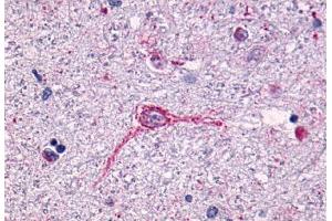 Anti-NTSR1 antibody  ABIN1049154 IHC staining of human brain, neurons and glia. (NTSR1 anticorps  (N-Term))