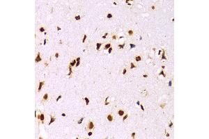 Immunohistochemistry of paraffin-embedded Mouse brain using Histone H3 antibody at dilution of 1:100 (x400 lens). (Histone 3 anticorps  (C-Term))