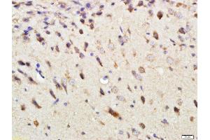 Paraformaldehyde-fixed, paraffin embedded rat brain, Antigen retrieval by boiling in sodium citrate buffer (pH6) for 15min, Block endogenous peroxidase by 3% hydrogen peroxide for 30 minutes, Blocking buffer (normal goat serum) at 37°C for 20min, Antibody incubation with DEPTOR Polyclonal Antibody, Unconjugated  at 1:500 overnight at 4°C, followed by a conjugated secondary and DAB staining.