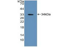 Detection of Recombinant PTPN2, Human using Polyclonal Antibody to Protein Tyrosine Phosphatase, Non Receptor Type 2 (PTPN2)