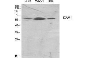 Western Blot (WB) analysis of specific cells using ICAM-1 Polyclonal Antibody.