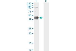Western Blot analysis of FCER2 expression in transfected 293T cell line by FCER2 monoclonal antibody (M03), clone S52.