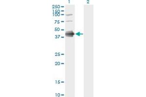 Western Blot analysis of FCER2 expression in transfected 293T cell line by FCER2 monoclonal antibody (M03), clone S52.
