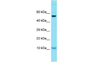 Host: Rabbit Target Name: GCSAML Sample Type: Placenta lysates Antibody Dilution: 1. (GCSAML anticorps  (N-Term))
