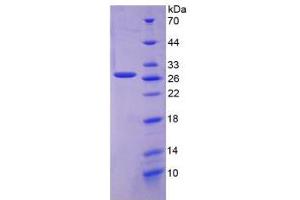 SDS-PAGE analysis of Human FOLR1 Protein. (FOLR1 Protéine)