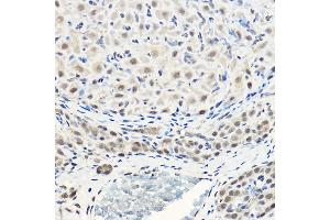 Immunohistochemistry of paraffin-embedded rat ovary using Pan-Akt Rabbit pAb (ABIN7265520) at dilution of 1:100 (40x lens). (AKT 1/2/3 anticorps)