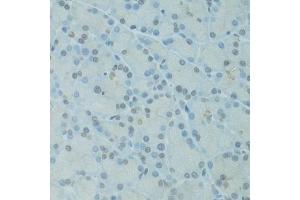 Immunohistochemistry of paraffin-embedded rat pancreas using GTF2H2C antibody (ABIN5973022) at dilution of 1/100 (40x lens). (GTF2H2C anticorps)
