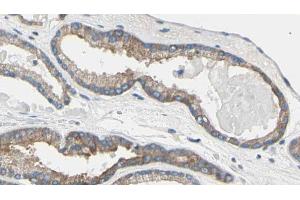 ABIN6269185 at 1/100 staining Human prostate tissue by IHC-P. (TNNI3 anticorps)